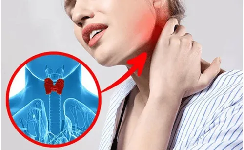 Hình ảnh về triệu chứng bất thường của tuyến giáp