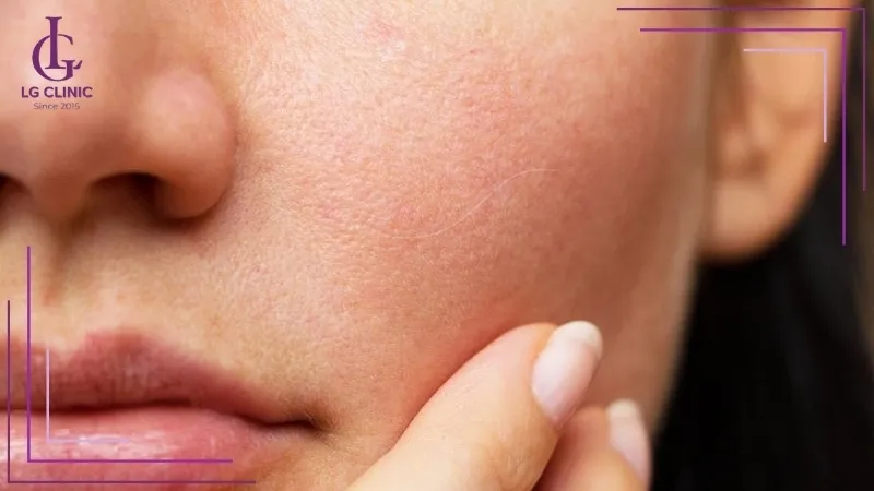 Hình ảnh lông trắng mọc 1 sợi trên má trái, biểu thị sự khéo léo và khả năng giao tiếp tốt