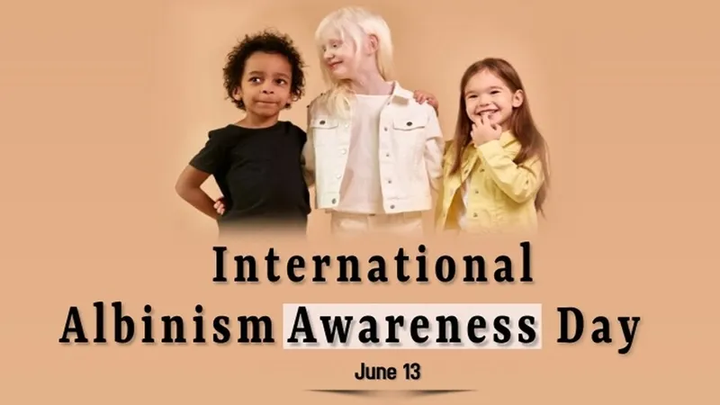 Ngày Nâng cao Nhận thức Bệnh bạch tạng